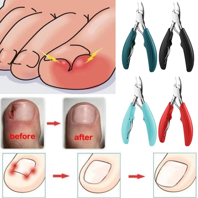 New Toenail Clippers Dead Skin Remove Nail Ingrown Nipper Cuticle Scissors Nail Cutter Paronychia Tools Pedicure Manicure